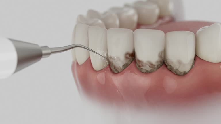 Reliable Dental Implants contractor in Salida, CO by Smile Center Dentistry